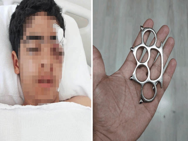 Esenyurt'ta 15 yaşındaki çocuk arkadaşı tarafından muştayla öldüresiye dövüldü!