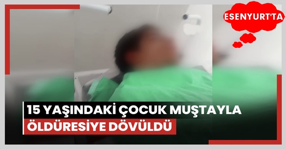 Esenyurt'ta 15 yaşındaki çocuk arkadaşı tarafından muştayla öldüresiye dövüldü!