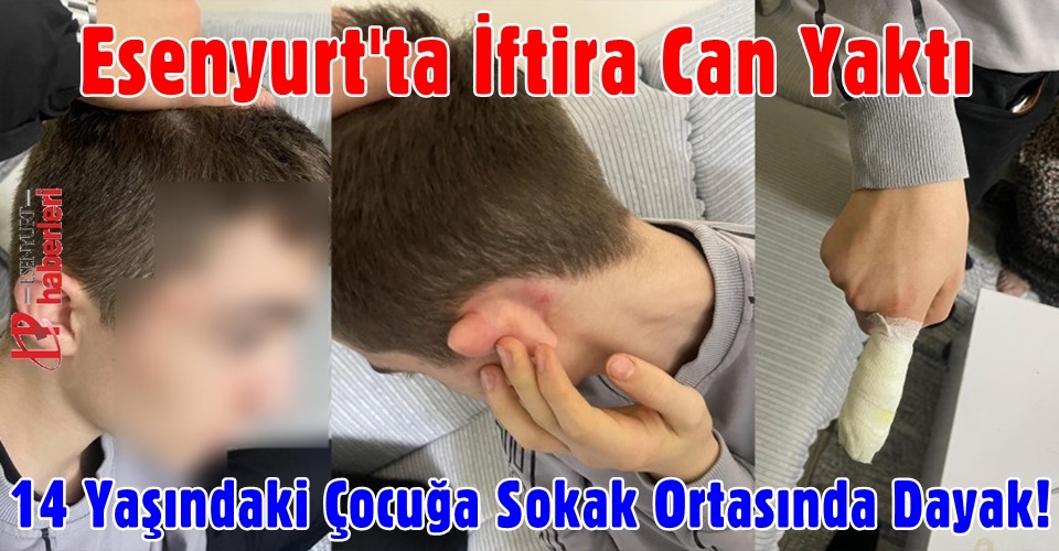 Esenyurt'ta İftira Can Yaktı: 14 Yaşındaki Çocuğa Sokak Ortasında Dayak
