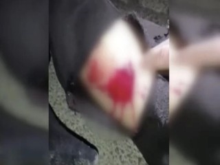 Esenyurt’ta başıboş köpekler sokakta yürüyen adama saldırdı